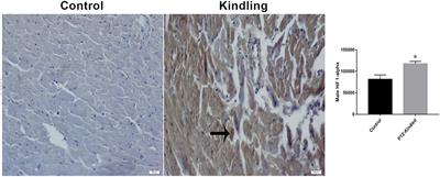 Myocardial Iron Overload in an Experimental Model of Sudden Unexpected Death in Epilepsy